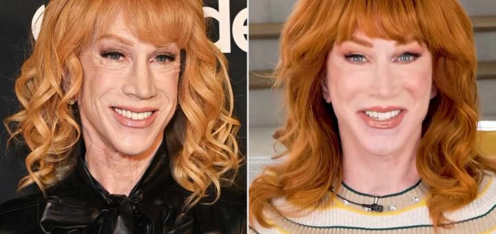 Kathy Griffin Unveils “New Face” After Third Facelift: Fans React